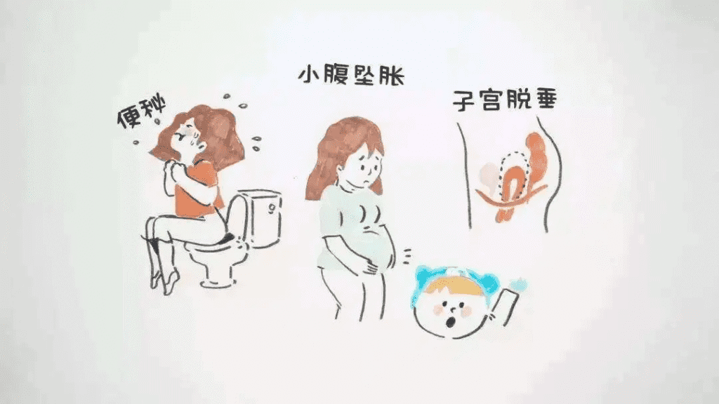 子宫脱垂/子宫下垂该怎么办