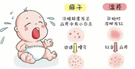 婴儿湿疹的症状,婴幼儿湿疹怎么办！