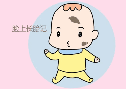 婴幼儿胎记有害吗？宝宝有胎记怎么办！