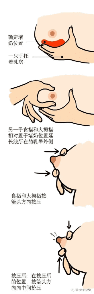 宝妈堵奶了怎么办丨乳汁淤积原因及危害