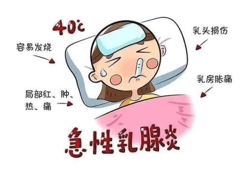 哺乳期乳腺炎怎么办丨一定要注意哺乳期乳腺炎