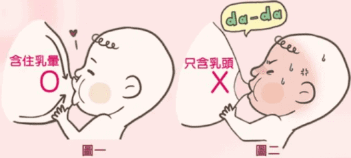 乳头皲裂该怎么办？这几个办法可以改善乳头破损