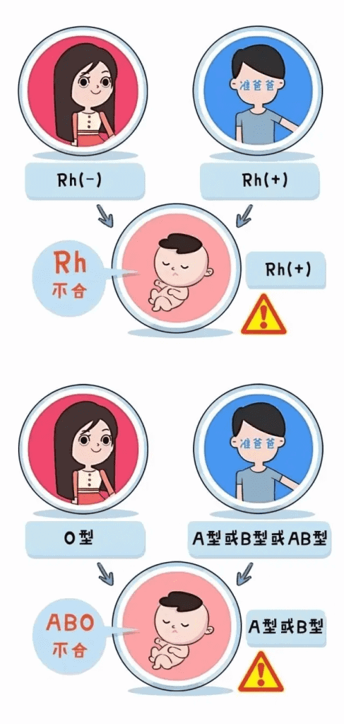 ABO溶血症的症状丨得了ABO溶血症怎么办